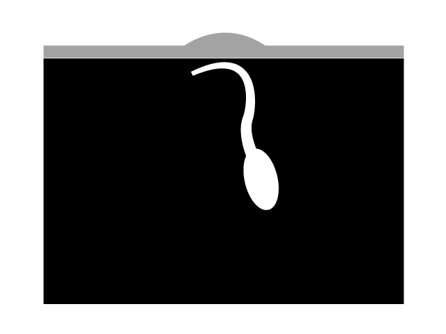 埋没毛 | 肌 - シンプル / クリップアート / アイコン / イラスト / 無料 / 白黒 / 二色 / PNG形式：背景透明